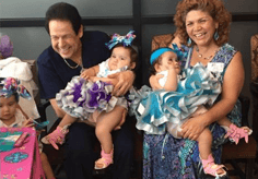 3D Systems Delivering a new life to Hernandez-Torres conjoined twins with VSP and 3D printed models