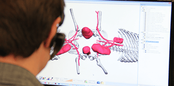 3D Systems Delivering a new life to Hernandez-Torres conjoined twins with VSP and 3D printed models